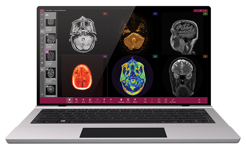 free dicom viewer with mpr