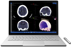 download the new for windows Sante DICOM Viewer Pro 12.2.8